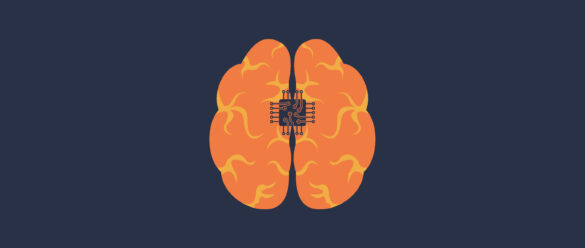 implantes cerebrales