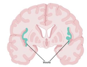 Fibromilagia en el cerebro 1