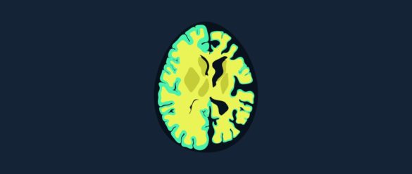 Demencias diagnóstico, tipos y clasificación