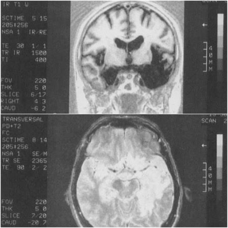 Imagen obtenida de Wilson et al. (1995).