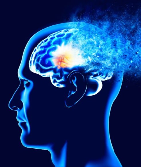 Corteza motora y dolor, reducción del dolor