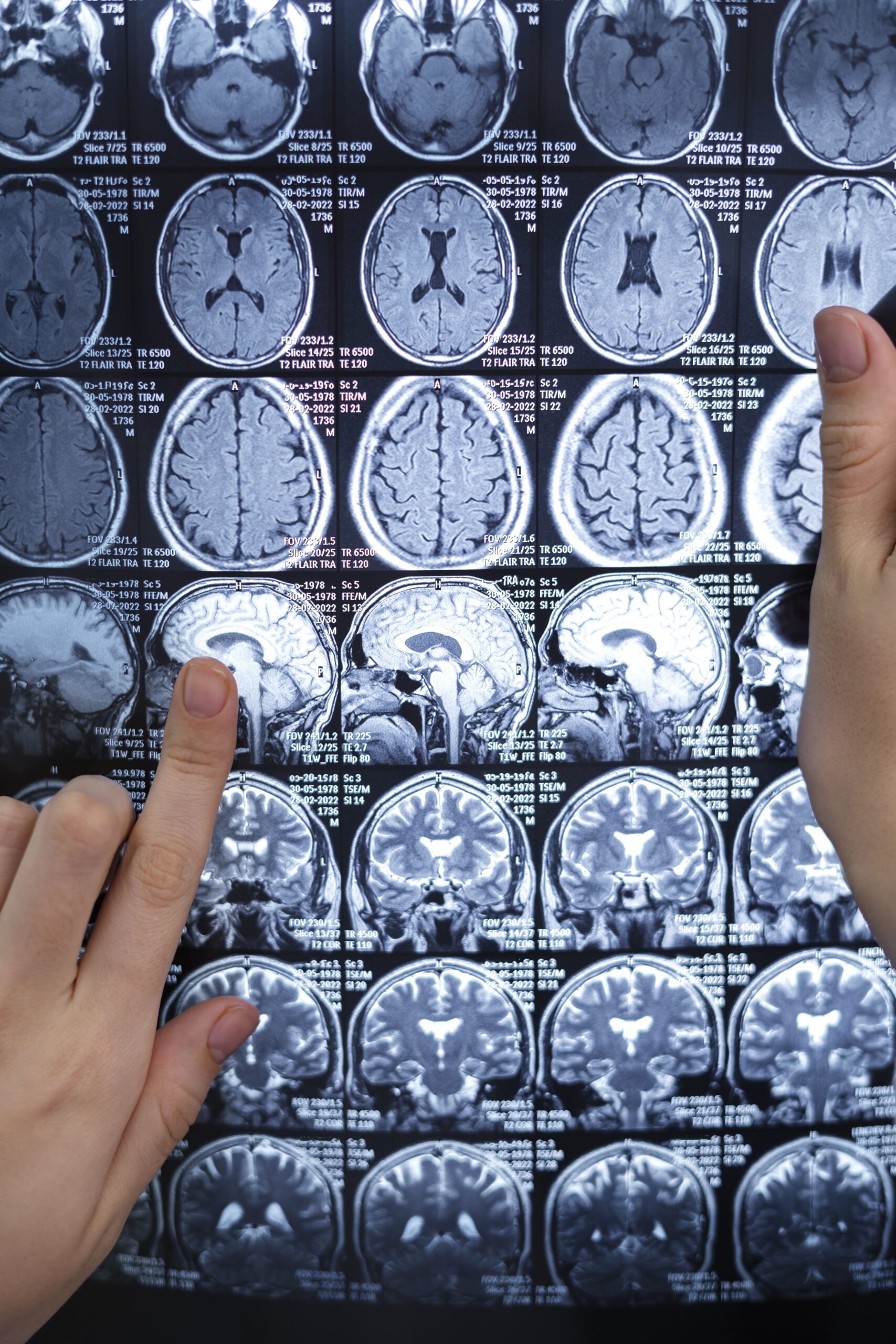 Cerebro y cambio, modelo de doble vía